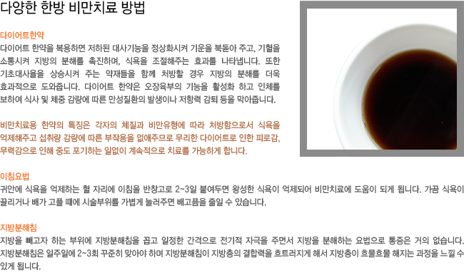 ���̾�Ʈ �Ѿ�. ��ħ���. �������ħ